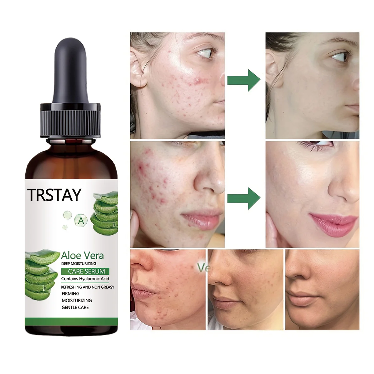 5ML/15ML/30ML/50ML/Aloe Vera Anti-aging Face Serum Vitamin E | Aloe Vera Hydrating Brightening Moisture Face Essence Dark Spots