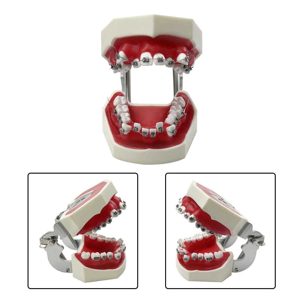 

Dental Model with Orthodontic Bracket Removable Dental Teaching Model Typodont with Red Wax For Dentist Patient Teaching Study
