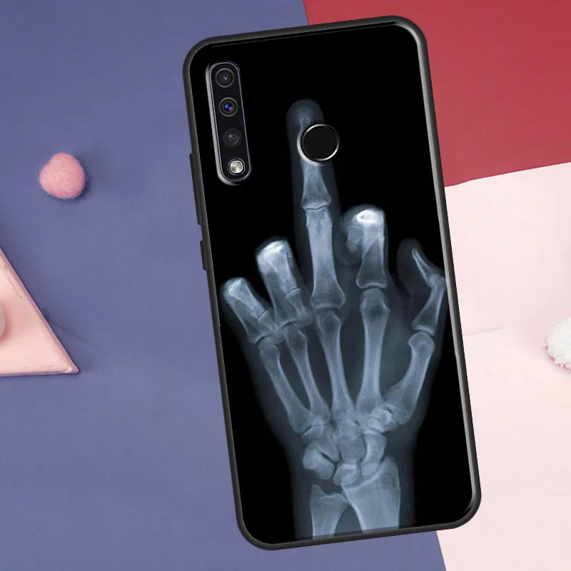 X-ray Hand Bones Case For Huawei P30 P20 P40 P60 Pro Nova 9 5T P Smart Honor Magic 5 Lite X8 X9a 50 70 Cover