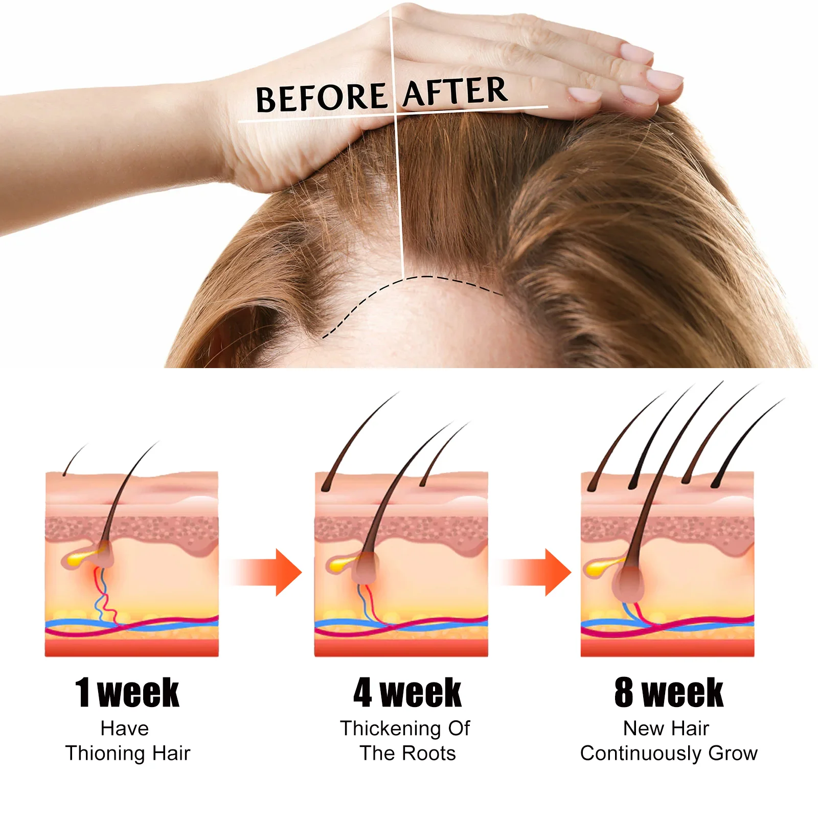 زيت نمو الشعر السريع أفريقيا مجنون الجر الثعلبة مصل مكافحة كسر الشعر رشاقته علاج تساقط الشعر رذاذ للرجل المرأة 60 مللي #4