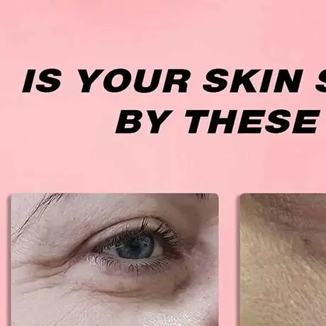 كريم جيلي الكولاجين للوجه يقلص المسام إصلاح حاجز الجلد ترطيب اشراق هلام جوهر النياسيناميد كريم وجه