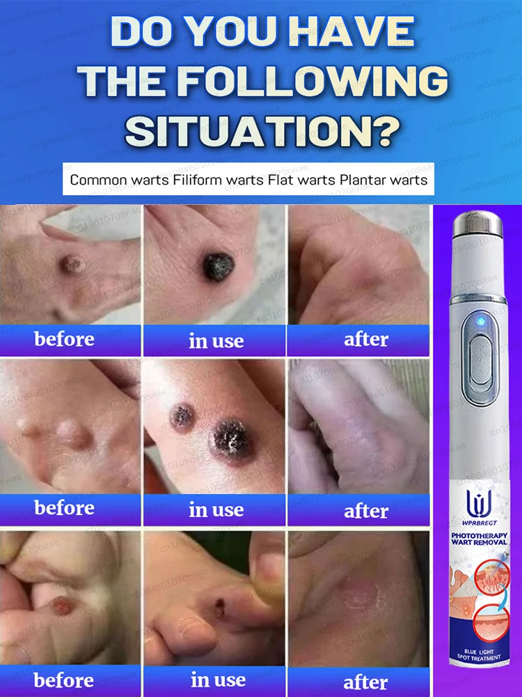 ᔆᴋɪɴ ᴍᴀɴᴀɢᴇᴍᴇɴᴛ ᴍᴀᴋᴇs ʏᴏᴜ ʟɪᴠᴇ ᴡɪᴛʜ ᴄᴏɴғɪᴅᴇɴᴄᴇ 問題を解決する