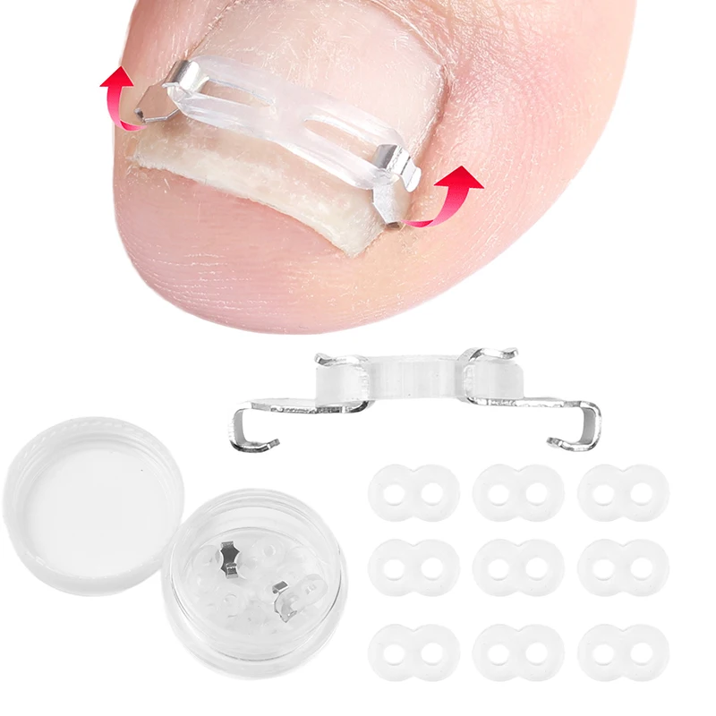 1/2 Set Strumenti per la correzione dell'unghia del piede incarnita Pedicure Recupera il trattamento dell'unghia del piede incorporato Strumento professionale per la correzione della cura del piede