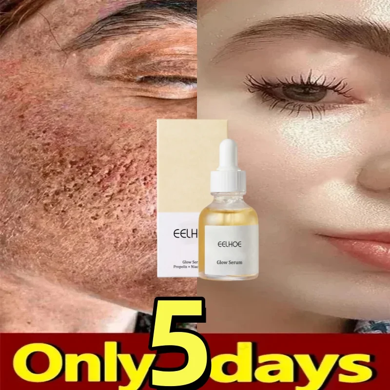 

New Pore Shrinking Glow Serum Propolis Niacinamide Acne Remove Sooth Sensitive Facial Redness Liquid Brightning Korean Skin Care