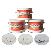 Fashion Braces 1 Pair Colorful Temporary Tooth Decoration With Metal Wires Metal Bracket Orthodontic Ligature Ties High Quality