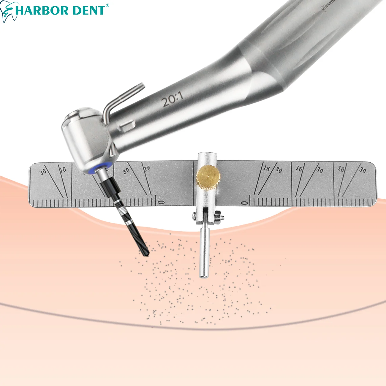 Dental Implant Locating Guide Autoclavable Surgical Planting Positioning Dentistry Tool Extra Two Spare Rulers