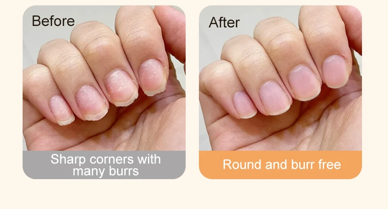 2-in-1 Elektrischer Nagelknipser, Maniküre Anti-Spritz-Nageltrimmer für Babys, Finger- und Zehenschere, Pediküre-Werkzeug für dicke Nägel – Detail 5