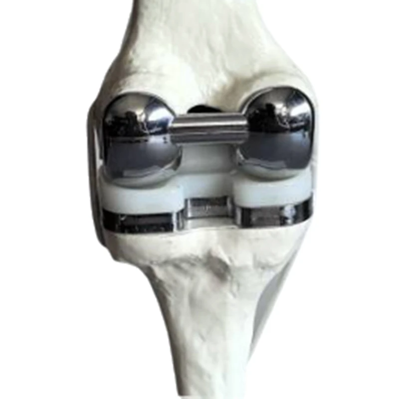 

ABEZ Knee Joint Model Simulation Replacement Surgery Meniscus Ligament Cartilages Surgery Model,Artificial Knee Joint