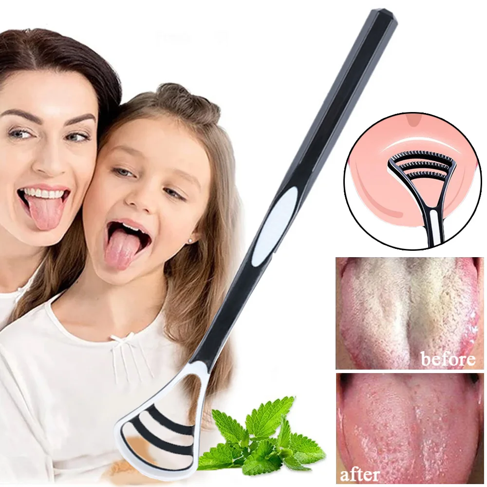 Tongue Coating Remover Set Effectively Scrapes Away White Coating Fights Bad Breath Black Oral Hygiene Tool for Family Use