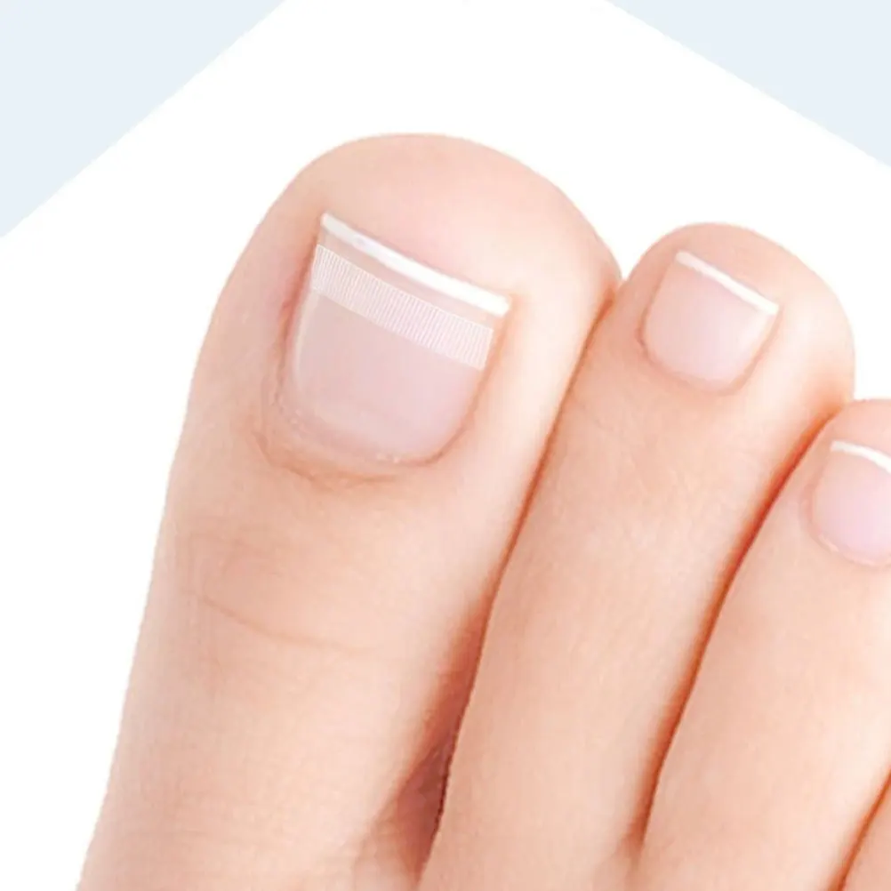 

5Pcs Foot Care Strips Ingrown Toenail Corrector Sturdy Fixation Long-Lasting Nail Treatment Solution French Manicure Strips