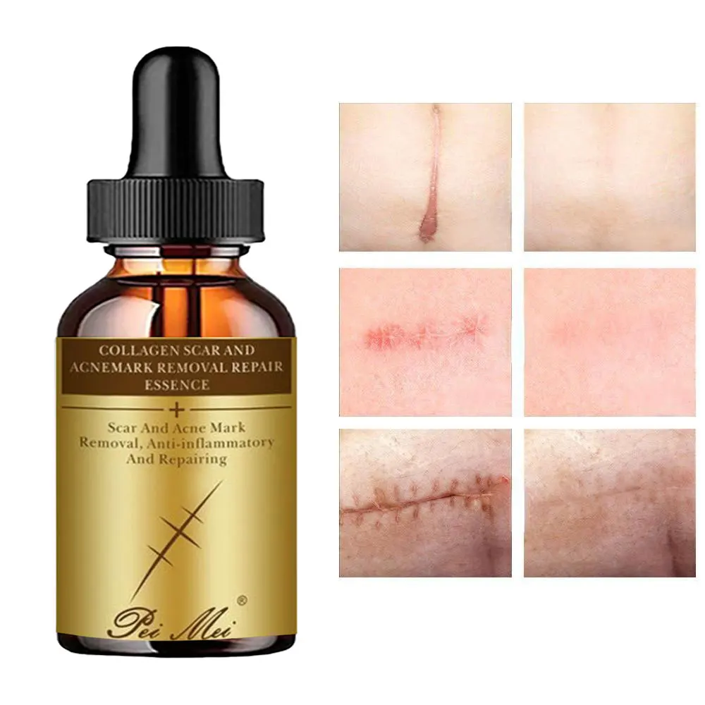 COLLAGEN SCAR AND ACNEMARK REMOVAL REPAIR ESSENCE