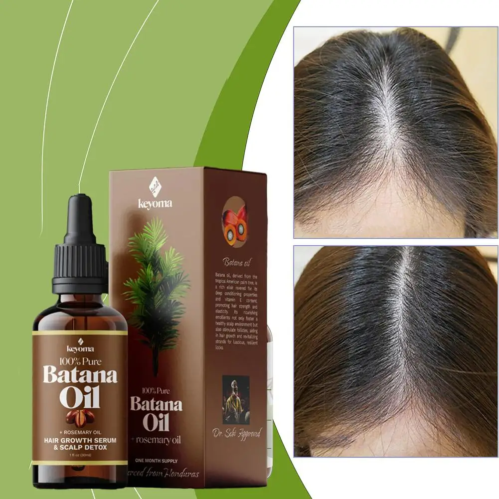 

Keyoma Batana Rosemary Mint Scalp Hair Strengthening Oil Biotin Essence Long-lasting Nourishing Moisturizing Repaired Hair Care