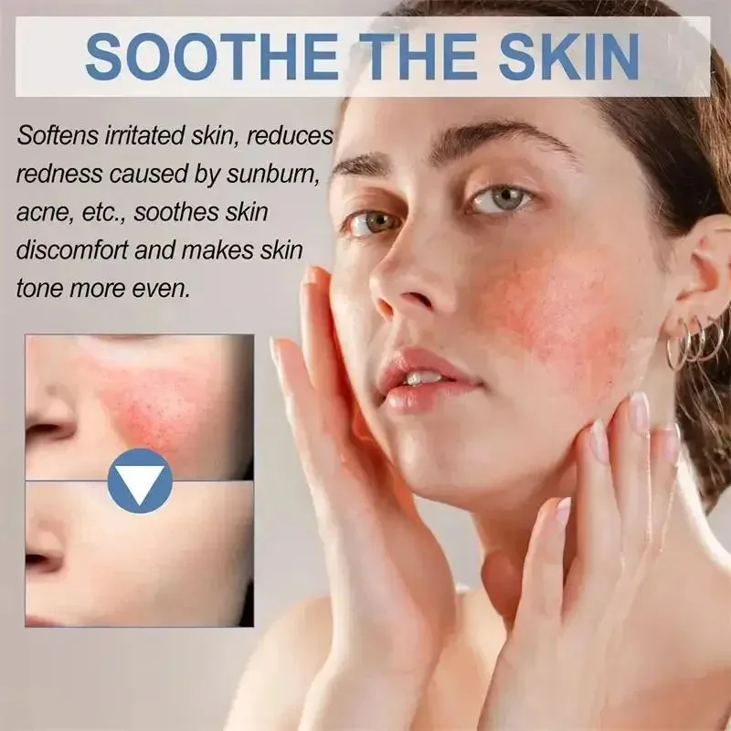 Krim Perbaikan pemerah wajah yang efektif perawatan jerawat merah muda Rosacea menenangkan meningkatkan kelembapan sensitif mencerahkan perawatan kulit