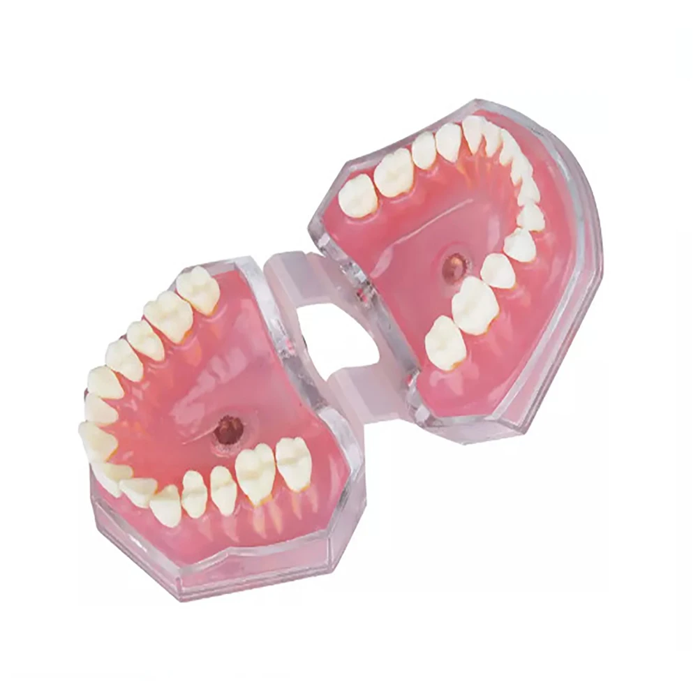 

Dental Teeth Model Teaching Study Demonstration Model Standard Adult Typodont Jaw Model For Practice Training Dentistry Products