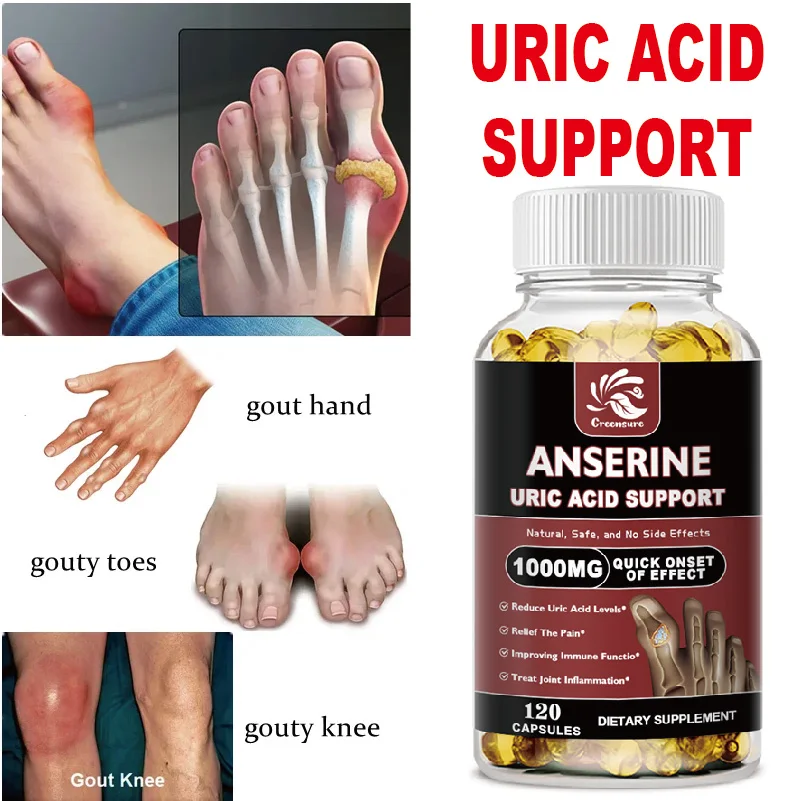 

Экстракт рыбы для сечевой кислоты, добавка для нижней подагры — ежедневное очищение почек, поддержка мочевой кислоты — добавка для суставов и детоксикация