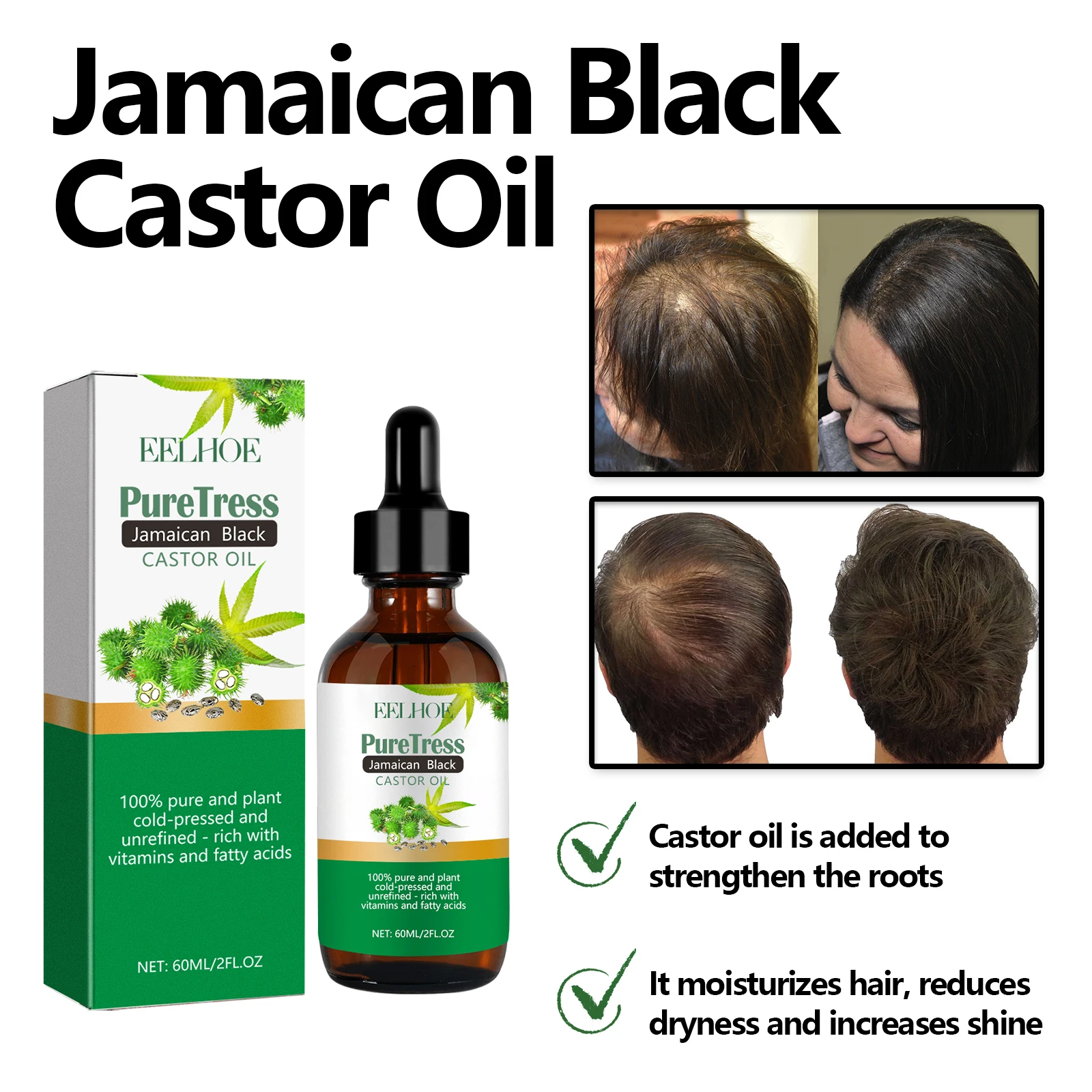 Castor Scalp Hair Strengthening Oil Biotin Essential Oil Deeply Moisturize For Frizzy Split Ends Dry All Types Hair Care Product