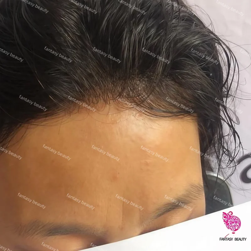 

Натуральная линия волос, плотность 80%-100%, супертонкая кожа 0,02-0,03 мм, полностью полиуретановая основа # 210 # Система замещения волос для мужчин 310 Black Gray (черно-серая)