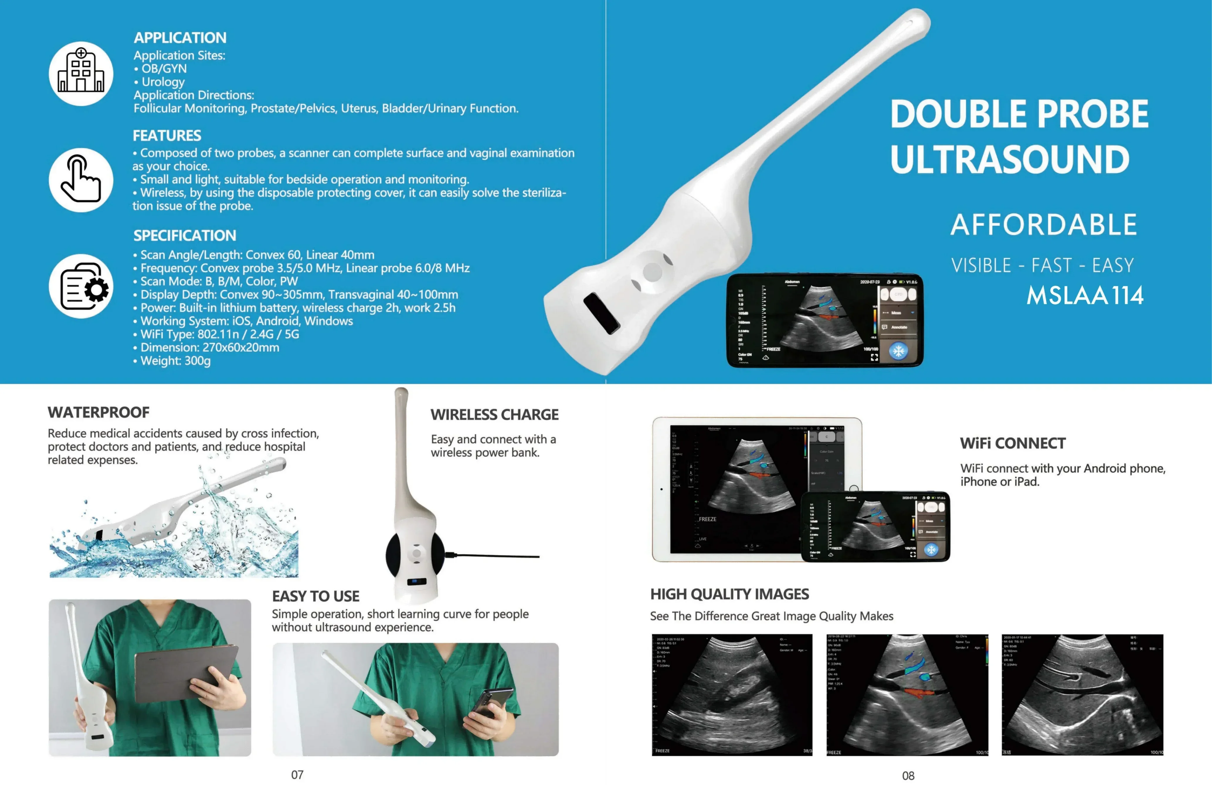 Portable Wireless Mini Ultrasound Diagnostic Equipment with Electric Power Source for Bladder Probe Medical Use