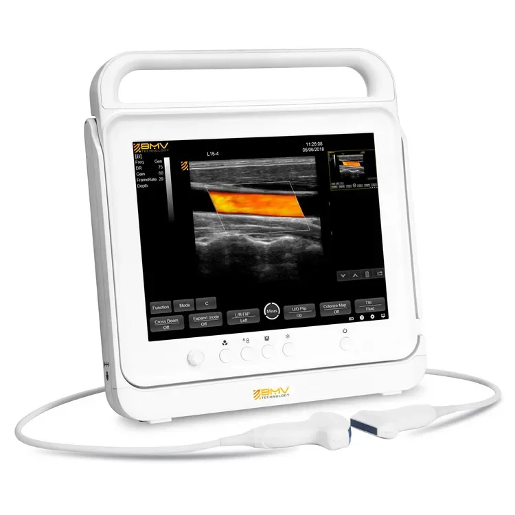 Portable ultrasonic machine veterinary pregnancy test horse dog vet 15