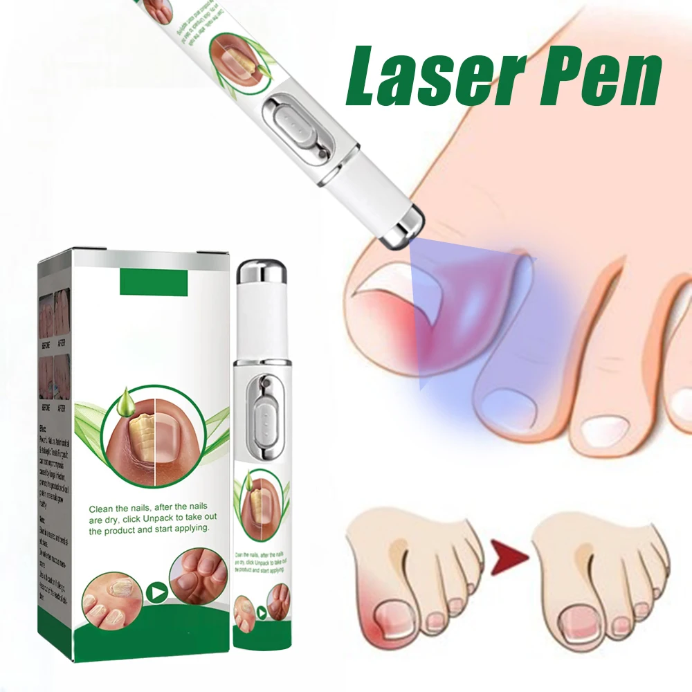 

Universal laser pen man and woman finger health tool blue light laser