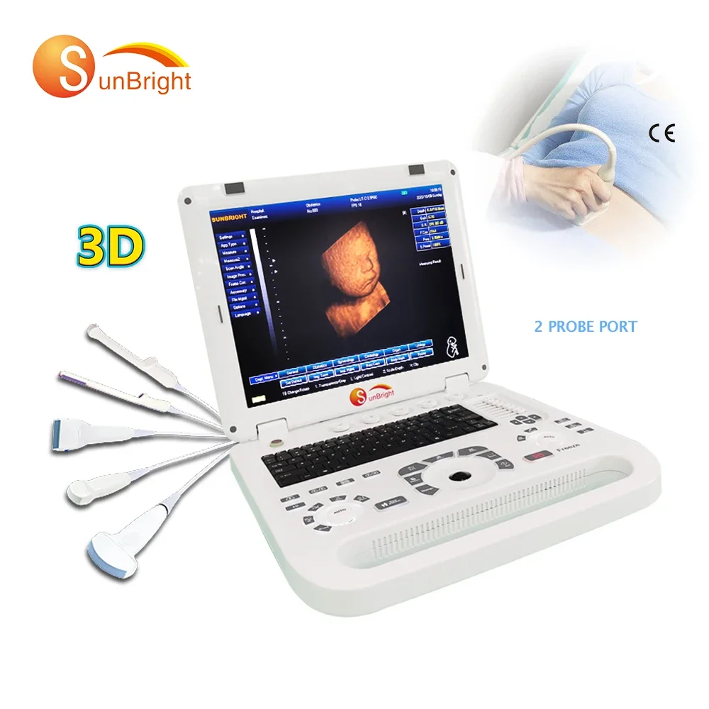 Hot Selling Laptop Digital Medical USG Machine 2D 3D Ultrasound Scanner SUN-800D4