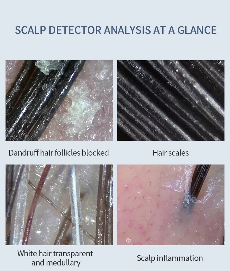 Portable 600x Wifi Digital Microscope With Wireless Hair Detector And analyzer