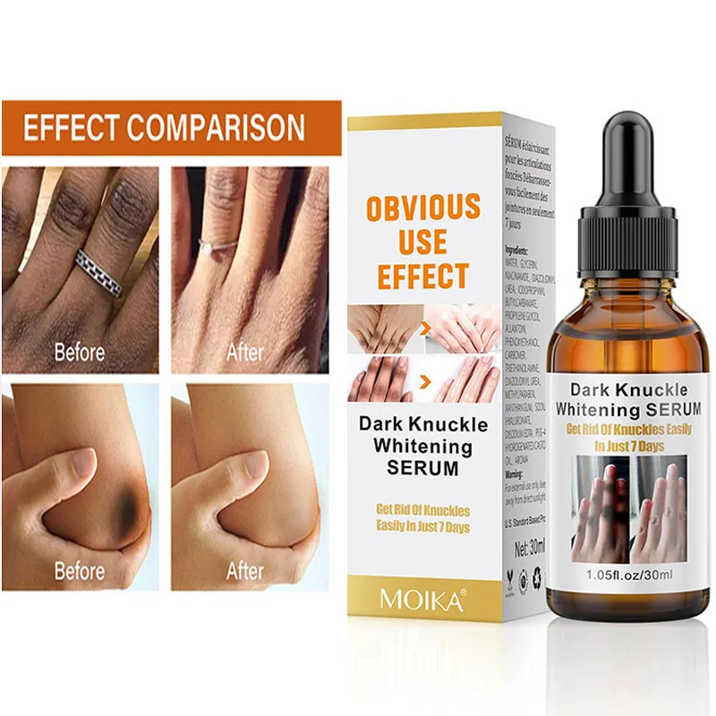 

Sdotter Dark knuckle whitening serum Underarm Elbow Knee Bleach Remove Melanin Body Whiten Cream Moisturizing Brighten Skin Care