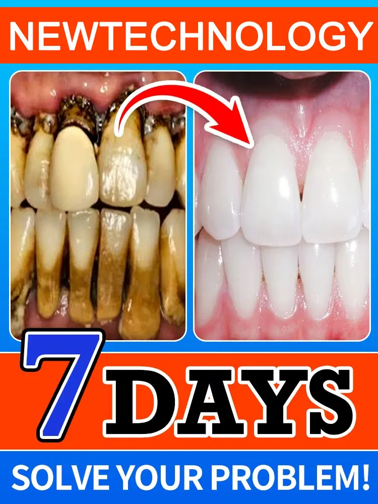 

Hot selling mousse Tooth decay