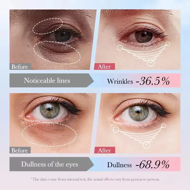 Creme instantâneo para remoção de bolsa de olhos, retinol, anti-rugas, firmador da pele, linhas finas, anti-círculo escuro, inchaço, iluminar, cuidados com os olhos