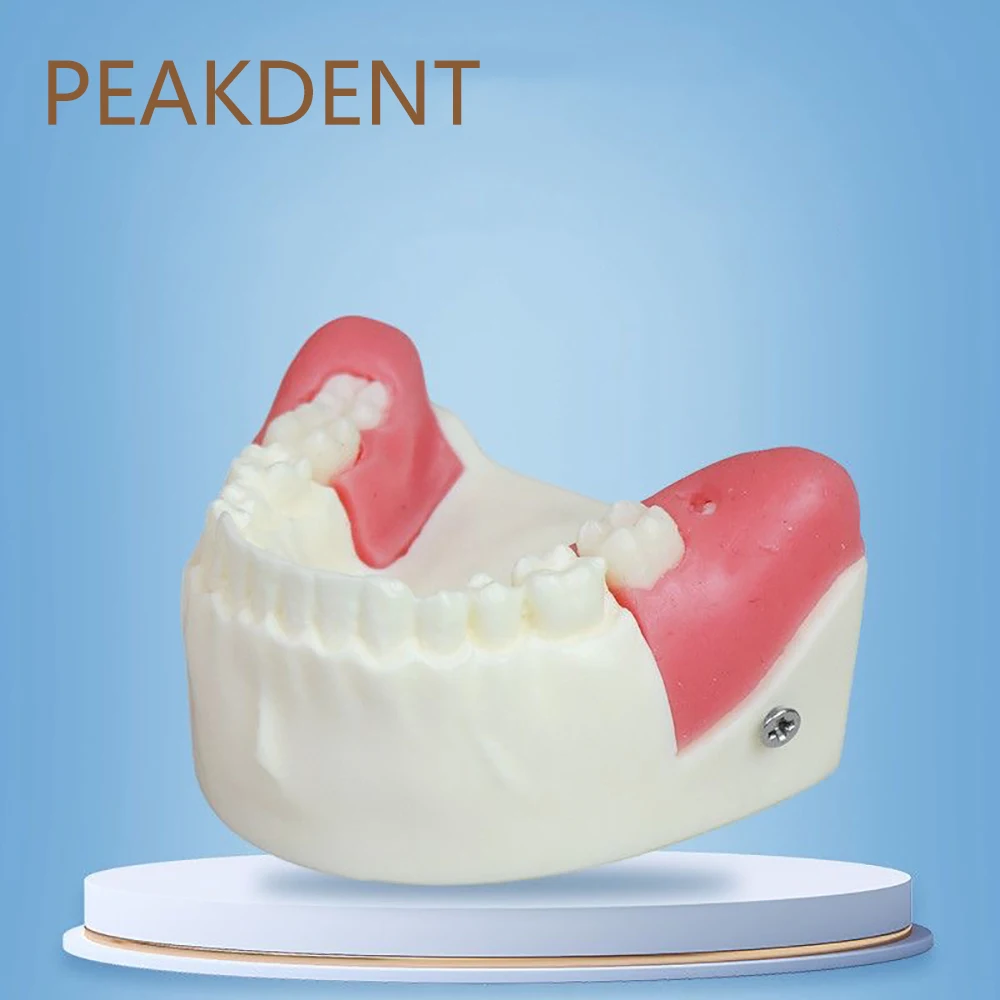 

Учебная модель для практики удаления витых зубов, модель зубов для обучения, учебное пособие для студентов-стоматологов