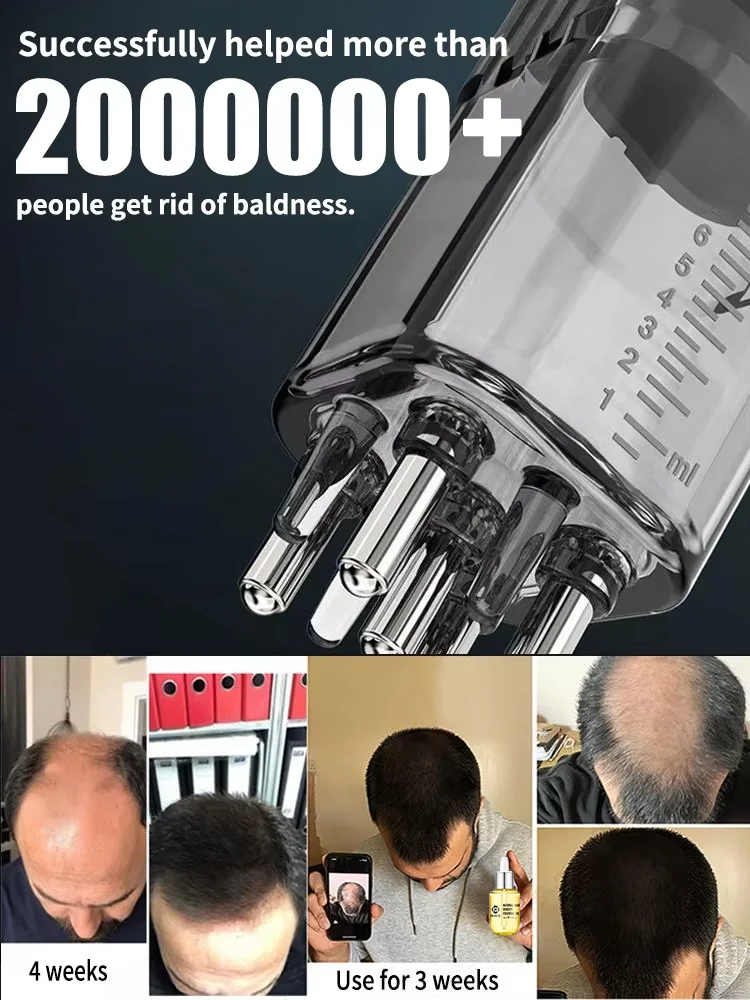 Pente aplicador de couro cabeludo, óleo de crescimento rápido do cabelo com guia líquido para óleos essenciais, ferramenta de cuidados capilares com controle de velocidade para couro cabeludo