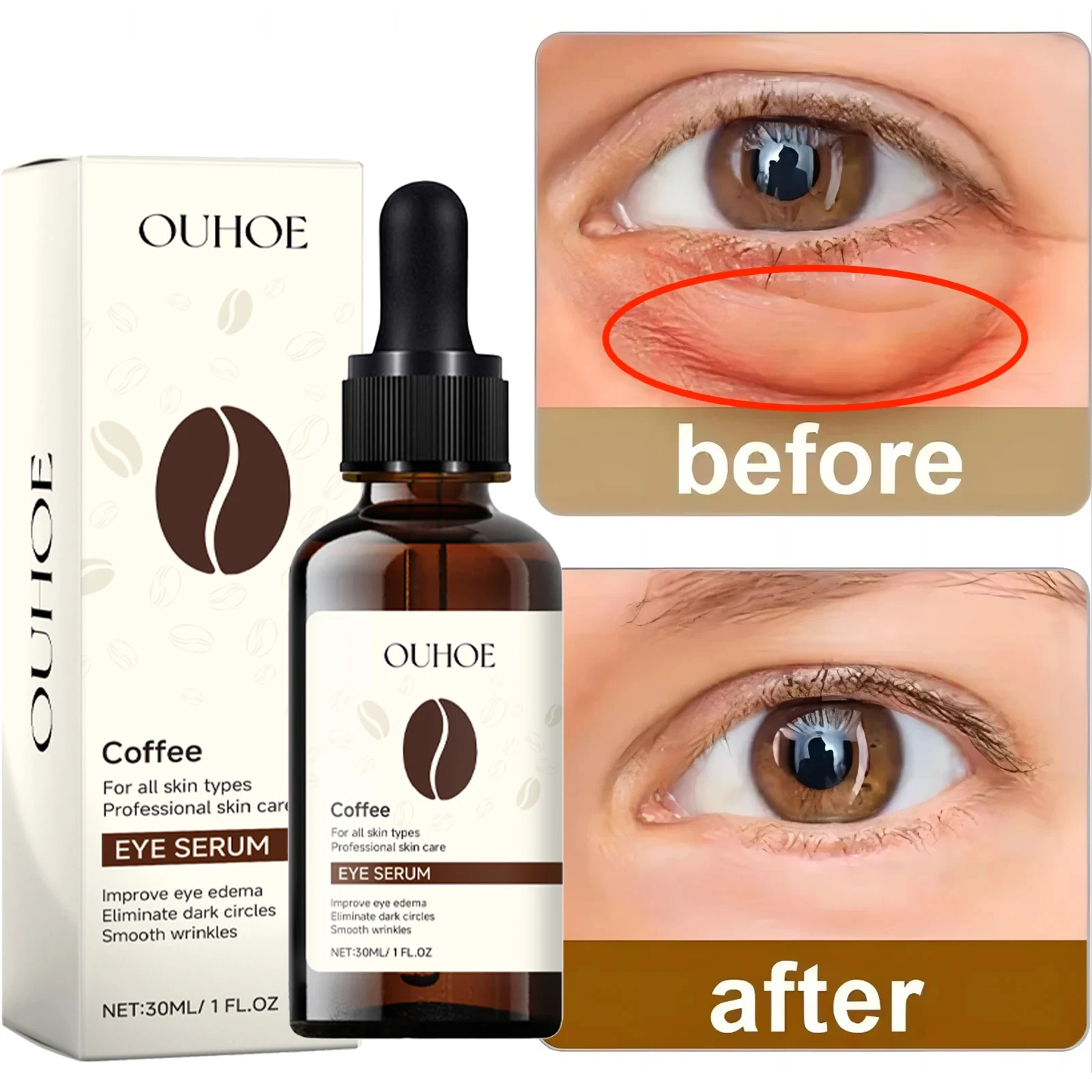 

Caffe Solution 5% + EGCG Eye Serum Remove Eye Bags Anti Puffiness Fades Dark Circles Firming Lifting Fade Fine Lines Skin Care