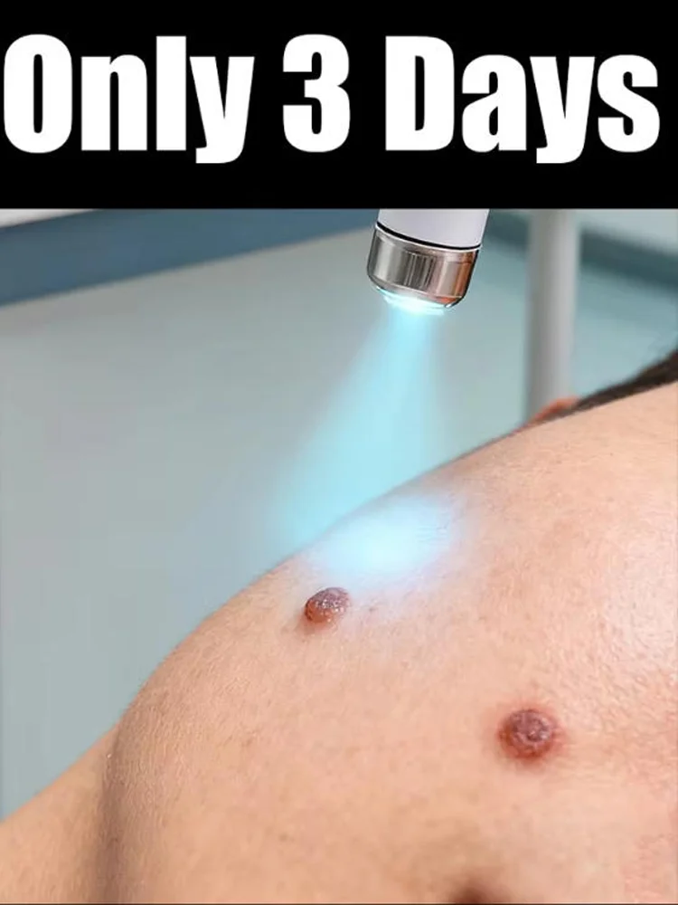 3nd ᵍᵉⁿᵉʳᵃᵗⁱᵒⁿ ᵘᵖᵍʳᵃᵈᵉᵈ wᵃʳᵗ ⸴ ʳᵉpᵃⁱʳ wᵃʳᵗˢ ʳᵒoᵗ ⸴ ᑫᵘⁱᶜᵏˡʸ 26