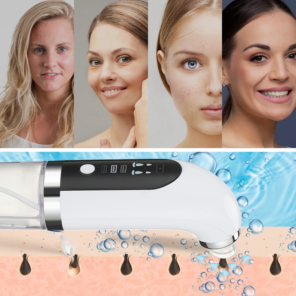 Electric Small Bubble Blackhead Remover Water Cycle Pore Acne Pimple Removal Vacuum Suction Facial Nose Cleaner Tool Skin Care