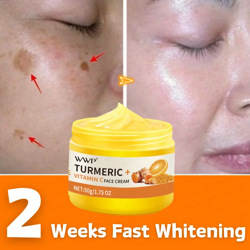 

Turmeric Vitamin C Whitening Freckle Face Cream Anti-Aging Moisturizing Dark Spot Corrector Removal Melasma SkinCare Product 50g