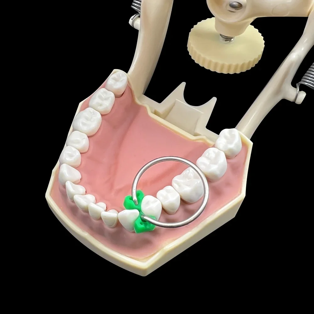 

30 × 40 шт./пакет, стоматологические силиконовые клинья, резиновые добавленные клинья, секционная матрица Delta, кольцо для зубов, стоматологические материалы, стоматологические инструменты, новинка