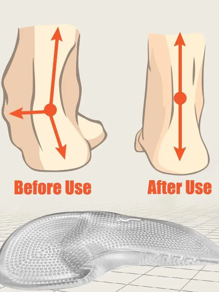 semelles-orthopediques-en-gel-de-silicone-pour-femmes-confortables-pour-pieds-plats-avec-soutien-de-la-voute-plantaire-et-coussinet-avant-nouveaute-hiver-20