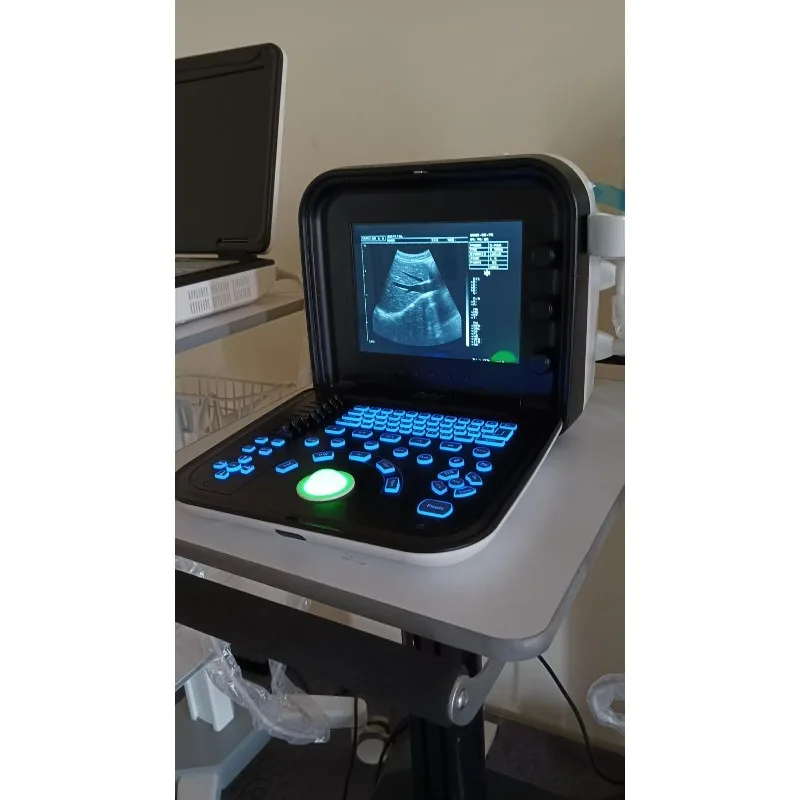 Vet Ultrasound Scanner High Imaging Quality  Ultrasound Scanner Veterinary Portable Ultrasound