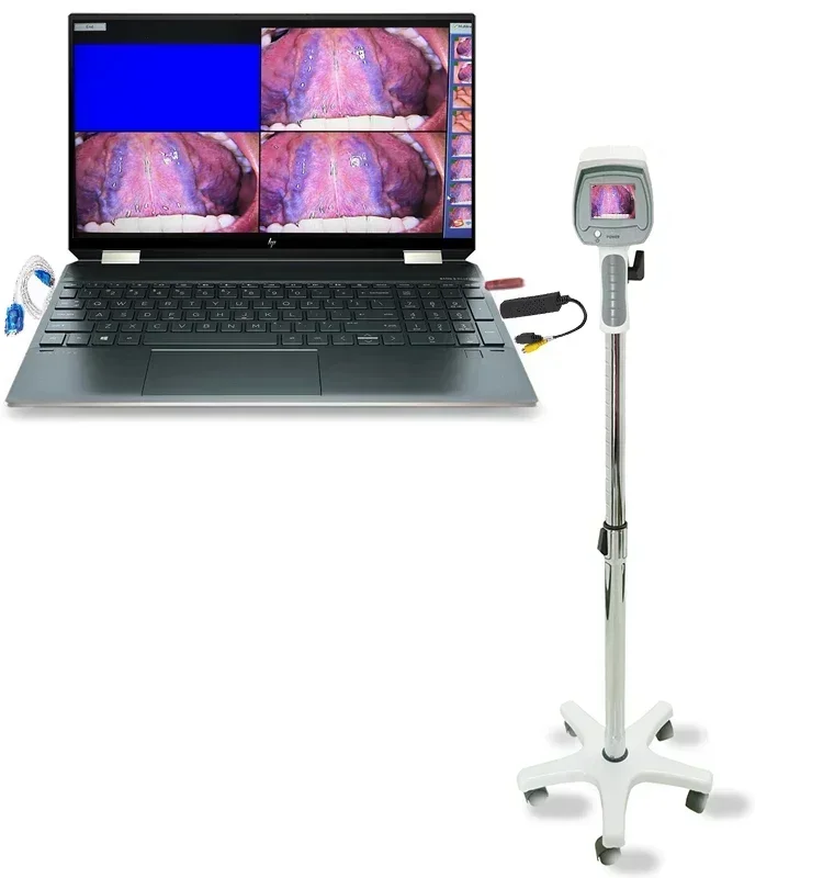 CE Approved Gynecological Portable Digital Colposcope