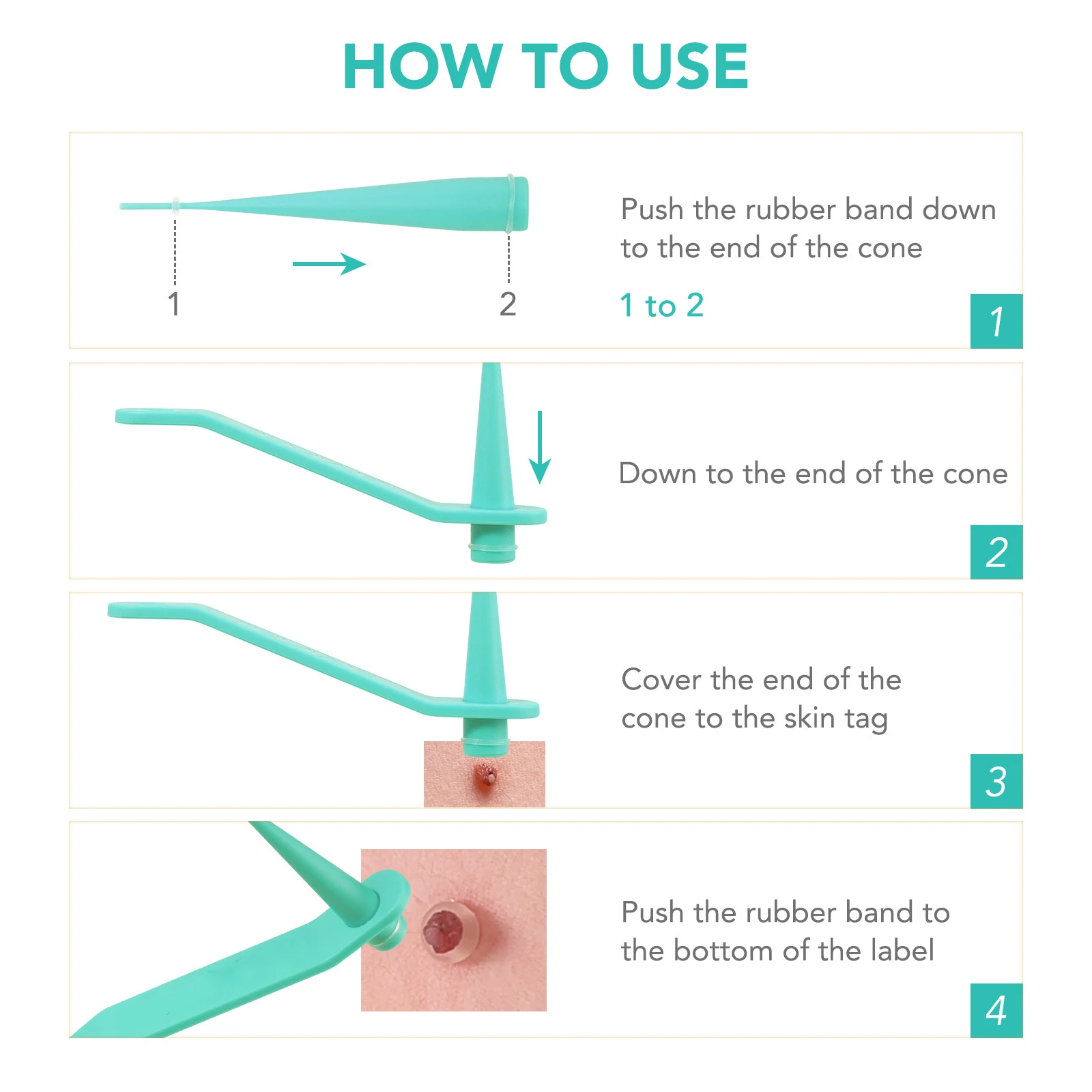 Skin Tag Removal Care Products Simple Wart Removal Tool Set Skin Tag Removeal Tool Easy To Clean Skin Care Tool