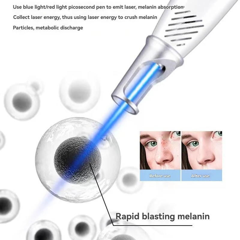 Портативное косметическое устройство, используемое пикосекундное лазерное перо для удаления родинок, темных пятен, тату, прыщей и пигментации кожи, без