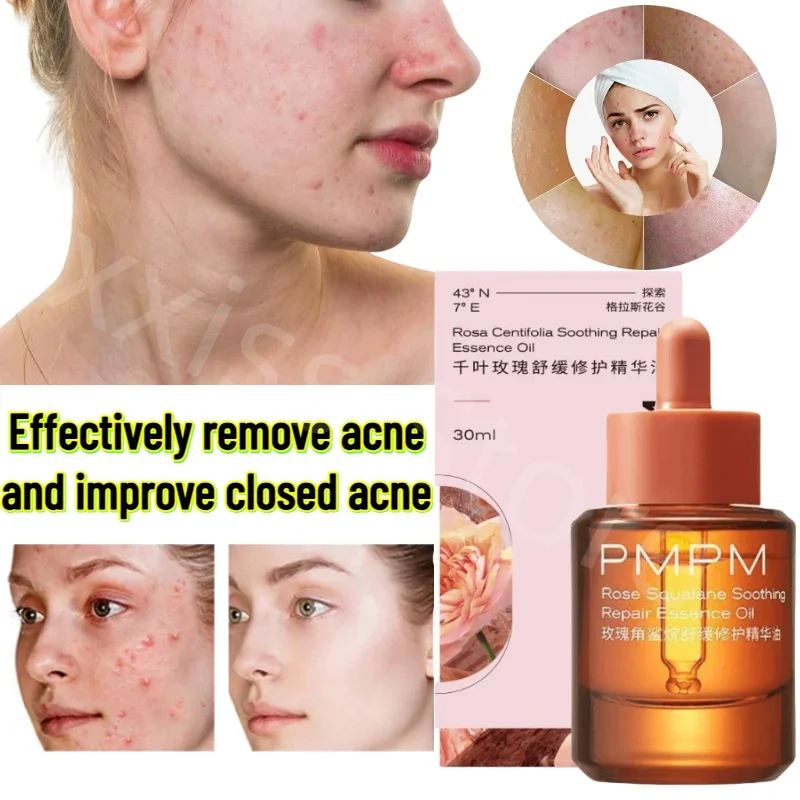 PMPM Centifolia Rose Essence Oil Sensitive Skin Essence Maintains Stability and Repairs Acne-prone and Red Skin 30ml