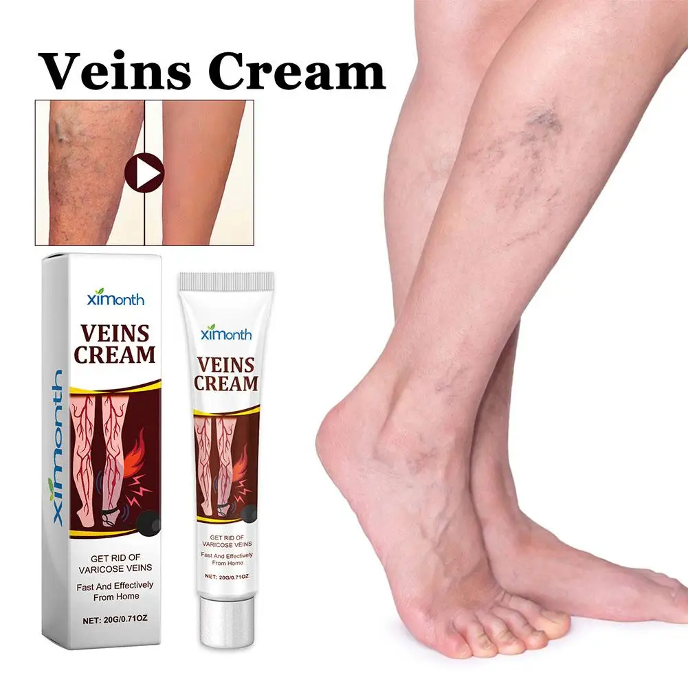 Crema per trattamenti delle vene efficace per alleviare le gambe vasculite dilatata flebite Formula naturale unguento per vene Varicose