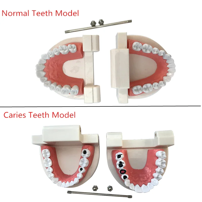 Dental Education Model With Caries Tooth Standard Teeth Model Dentist Teaching Study Typodont Brushing Teeth Demonstration Tools