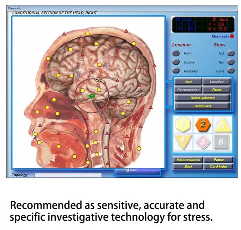 2023년 핫세일 3D NLS 양자 바이오 공명 분석기 자기 공명 검사기 신체 건강 분석기 (소프트웨어 포함)