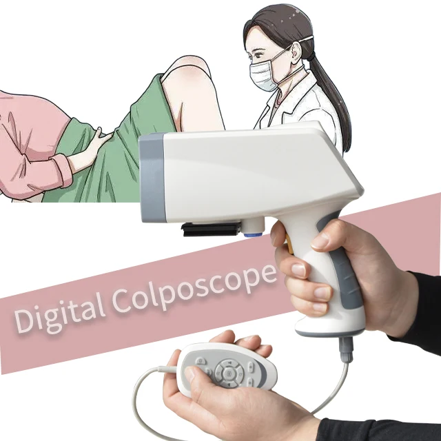 Kernel Kn-2200 Portable Colposcope Gynecology Examination Video Digital Colposcopy for Clinic use