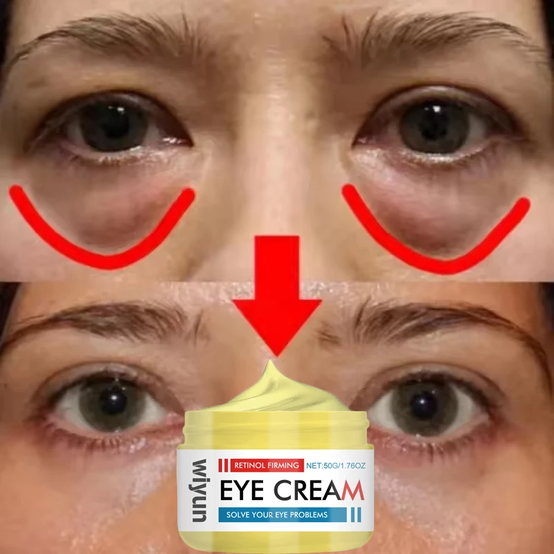 Instant Eye Bag Removal Cream Retinol Anti-Wrinkle Firming Skin Fade Fine Lines Anti Dark Circle Puffiness Brighten Eye Care