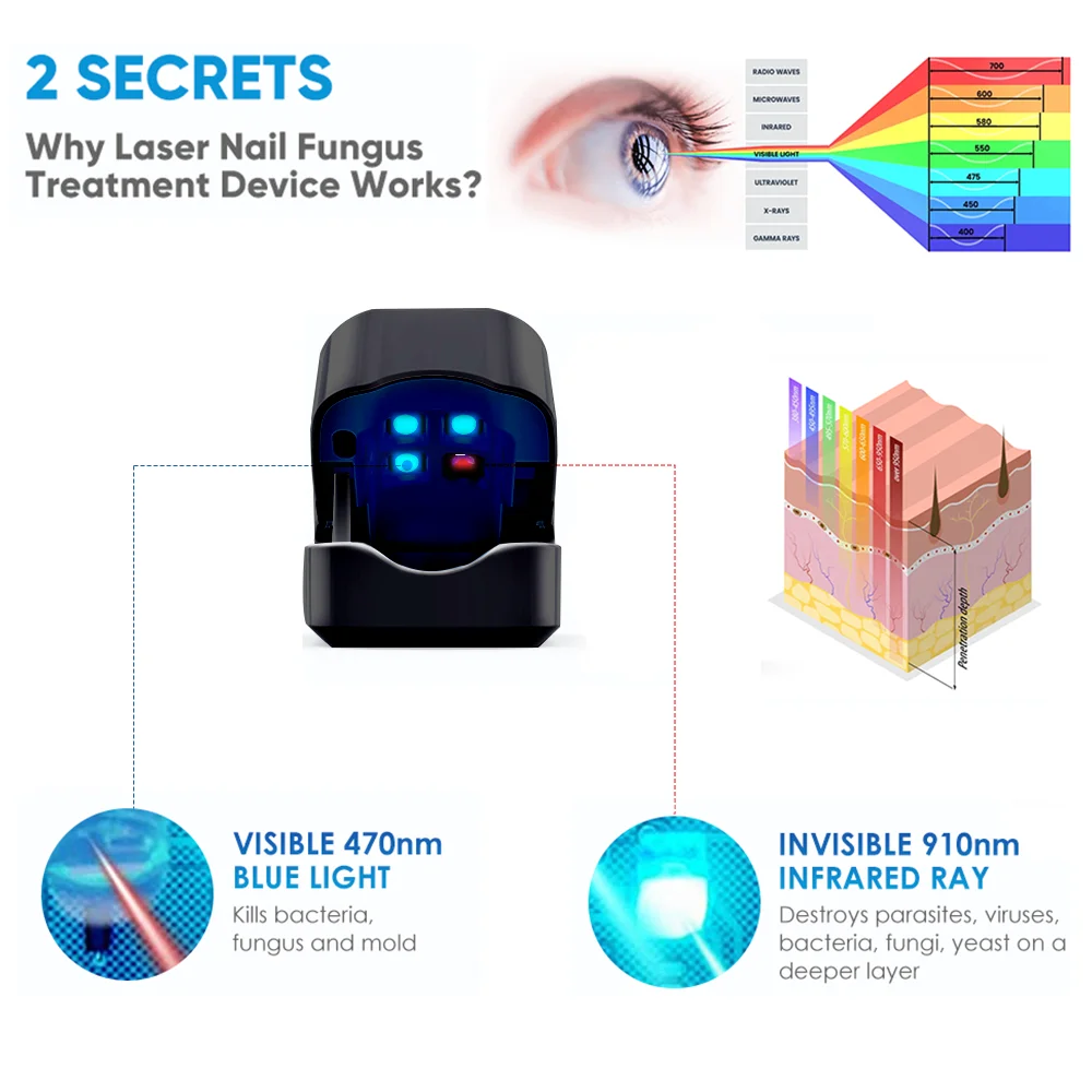 JUSTLANG Rechargeable Fungus Grey Nail Treatment Device Portable Onychomycosis Treatment Laser Therapy Relieve Ingrown Foot Care