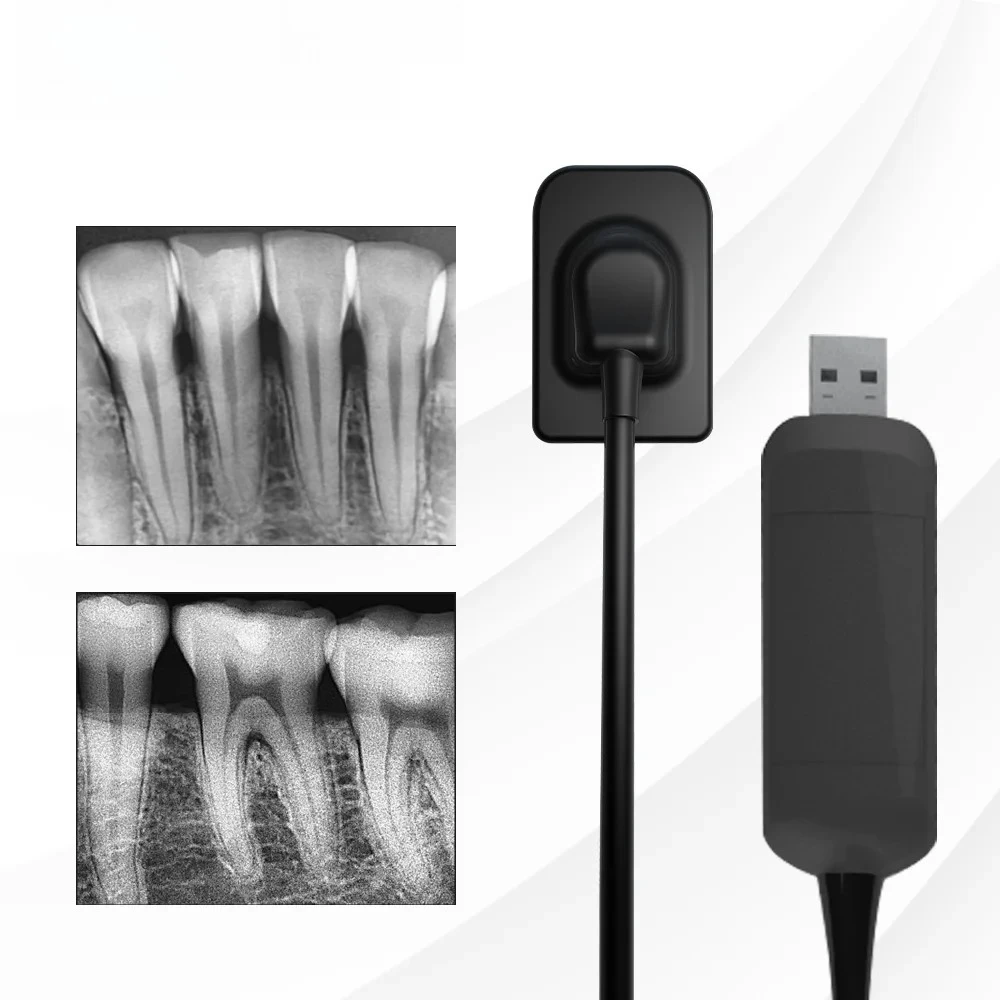 SIBODENT       Sensor X-Ray High-Frequency Rx Digital Intraoral Digital System H D Image       X RAY Sensor    Tools