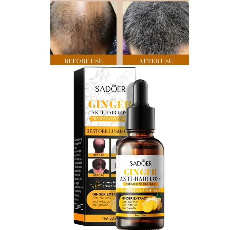 Ginger Hair Growth Serum Rapid Hair Growth Oil Repair and Improve Dry Curly Hair Care Treat Scalp for Longer Thicker